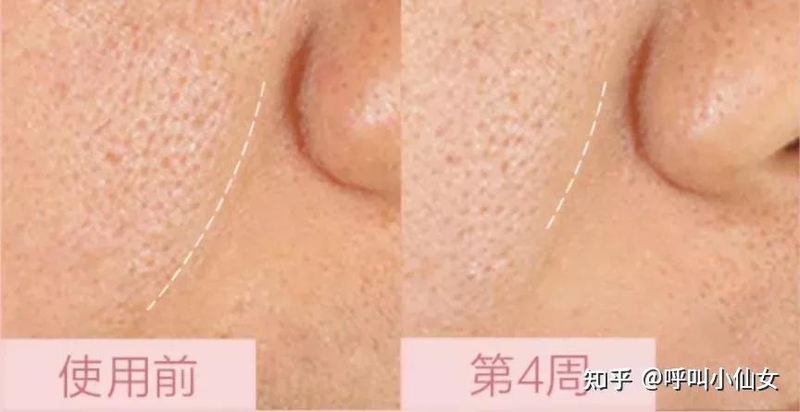 兰蔻化妆品价格