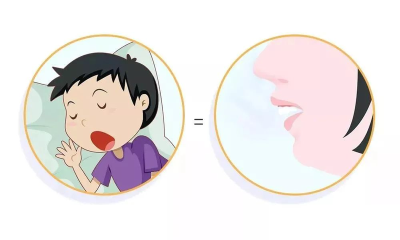 儿童窝沟封闭知识