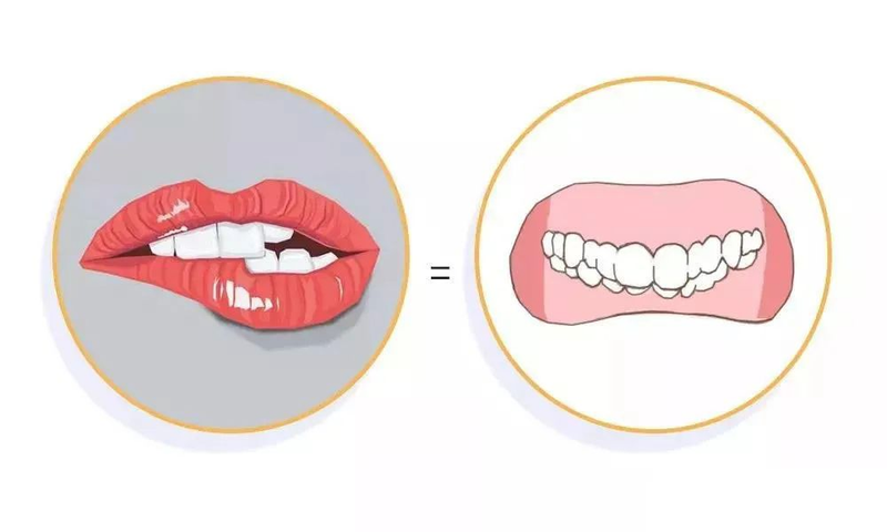 儿童窝沟封闭知识