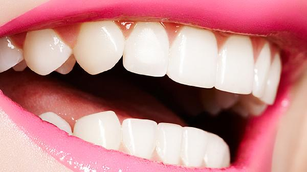 做四环素牙美白价格大概需要多少