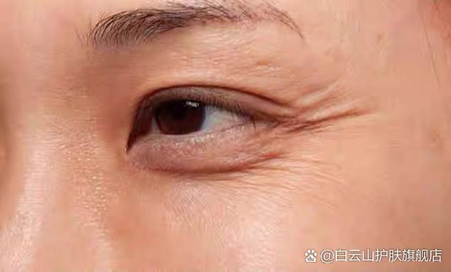 Eyebrowtail removal method