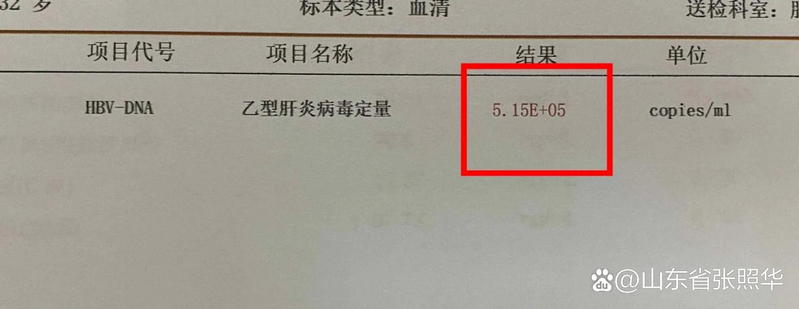 乙肝dna检测方法