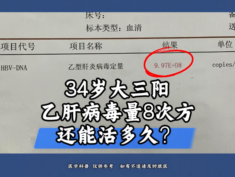 乙肝dna检测方法