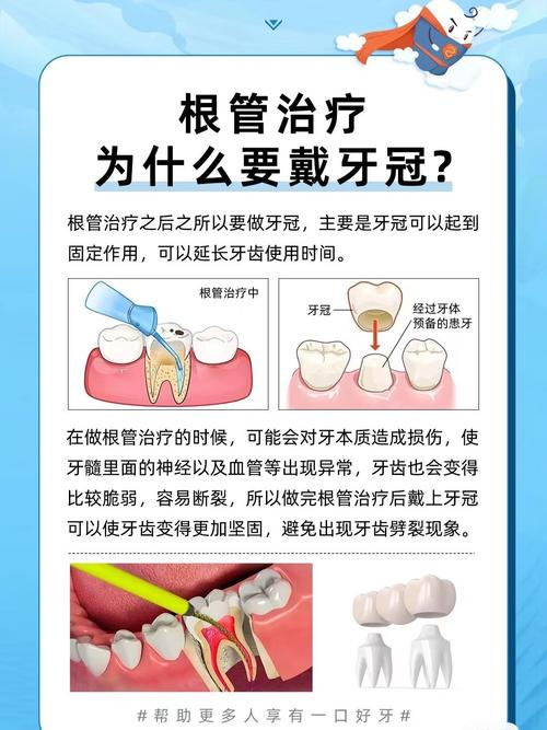 口腔根管治疗的步骤