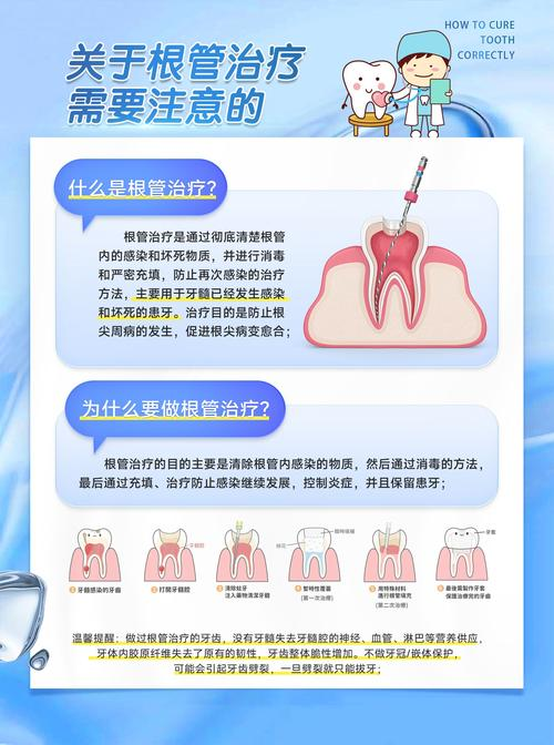 口腔根管治疗的步骤