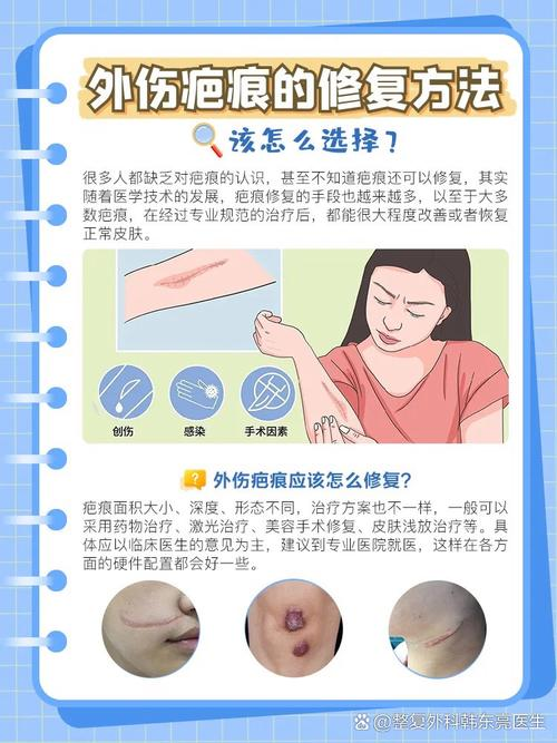ffs疤痕种植技术