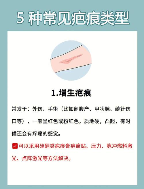 ffs疤痕种植技术