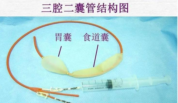 三腔二囊管护理经验