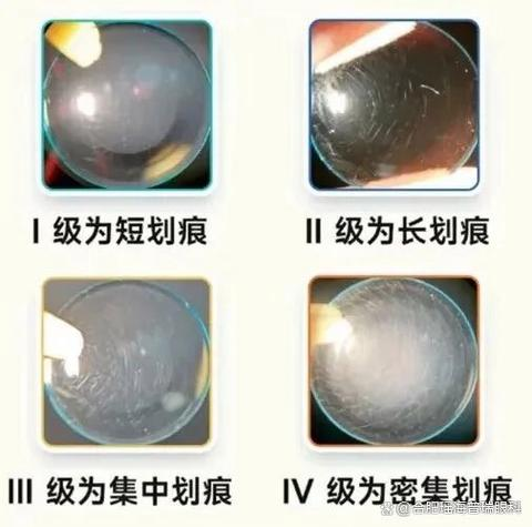The working principles of near-sighted glasses