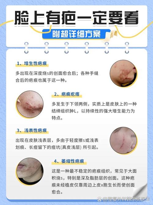 ffs疤痕种植技术