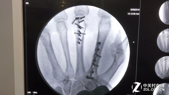 电脑水冷散热器构造