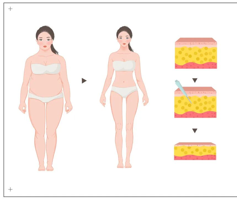 ffs疤痕种植技术