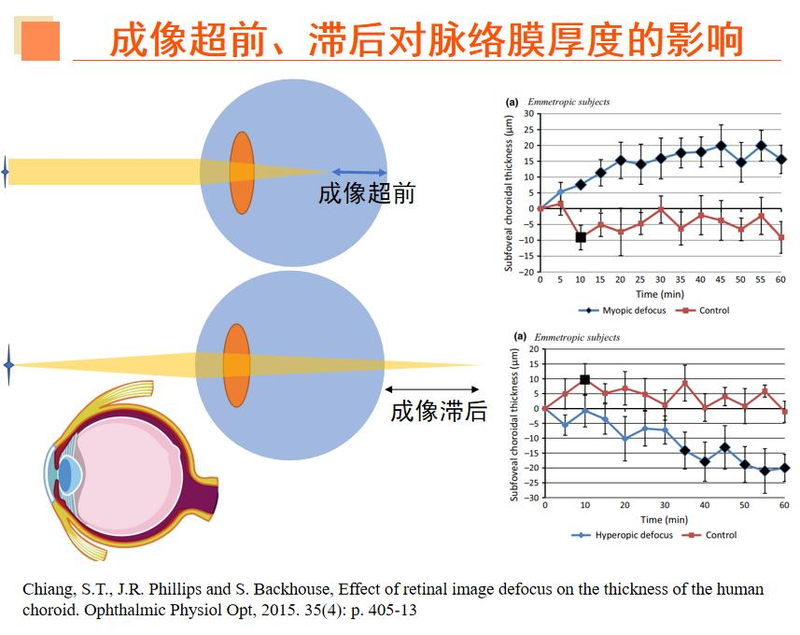 近视眼镜工作原理