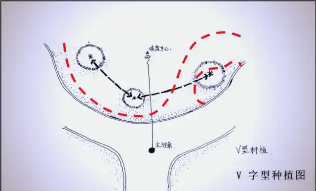 景观树的种植技术