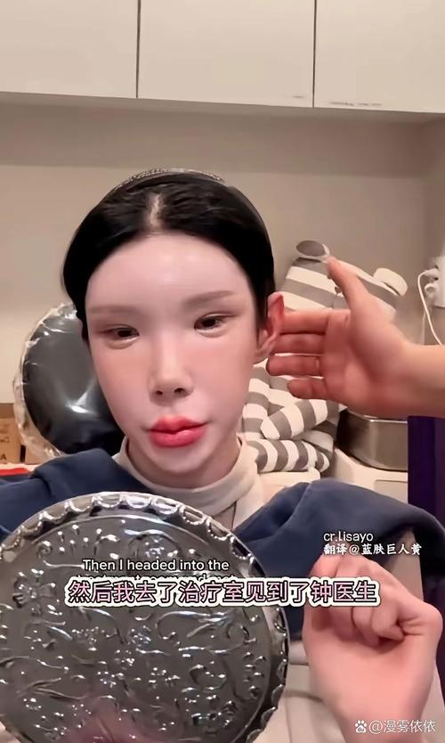 Price of thin face needles