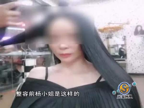 垫下巴假体费用