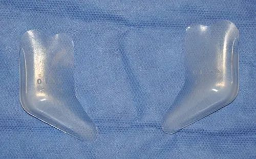 垫下巴假体费用