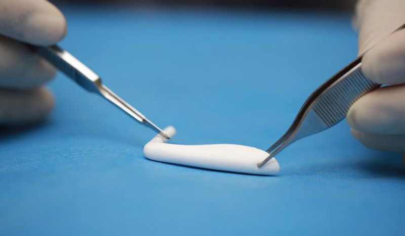 垫下巴假体费用