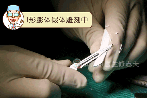 垫下巴假体费用