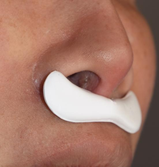 垫下巴假体费用