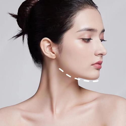 垫下巴假体费用