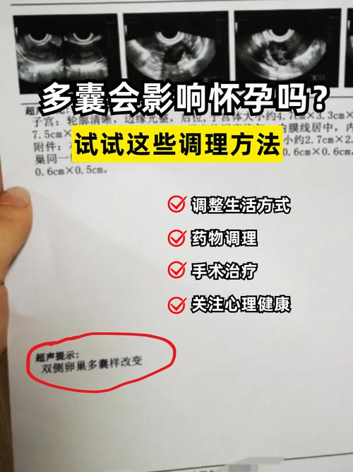 多囊减肥成功怀孕经验