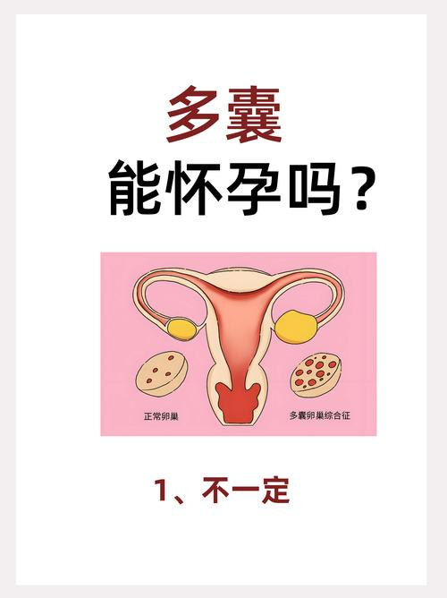 多囊减肥成功怀孕经验