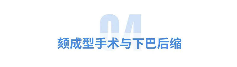 垫下巴假体费用