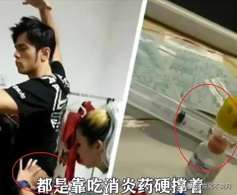 强直性脊椎炎的治疗方法