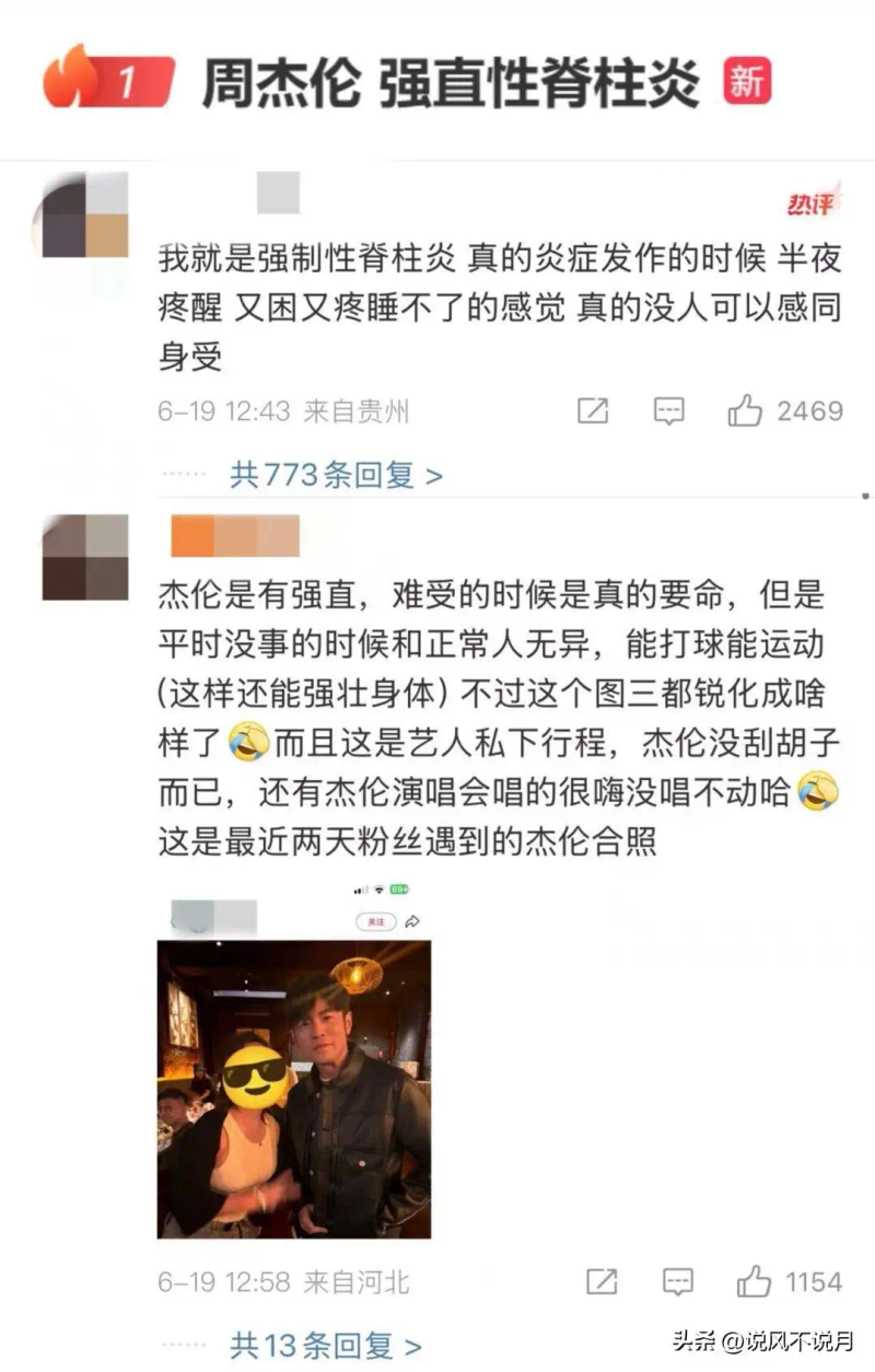 强直性脊椎炎的治疗方法