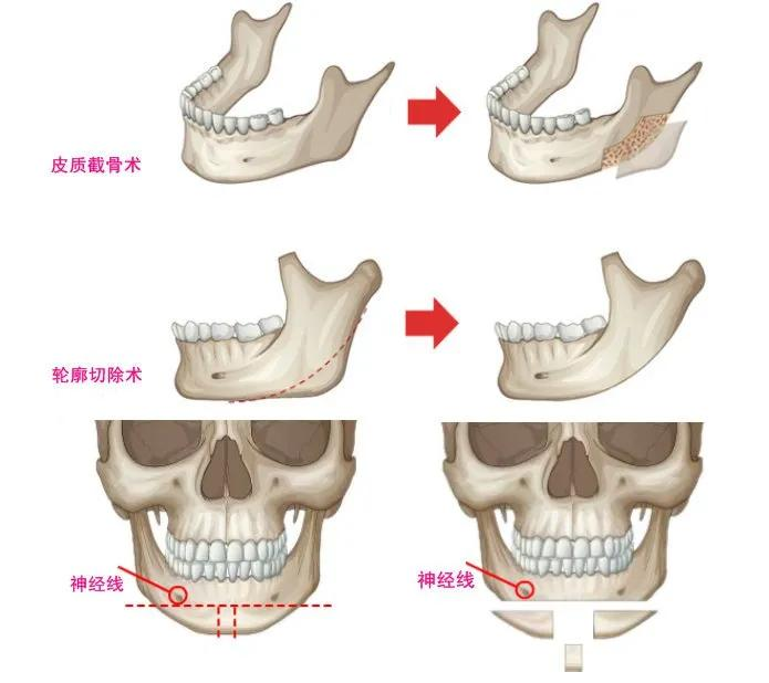 Related knowledge of plastics