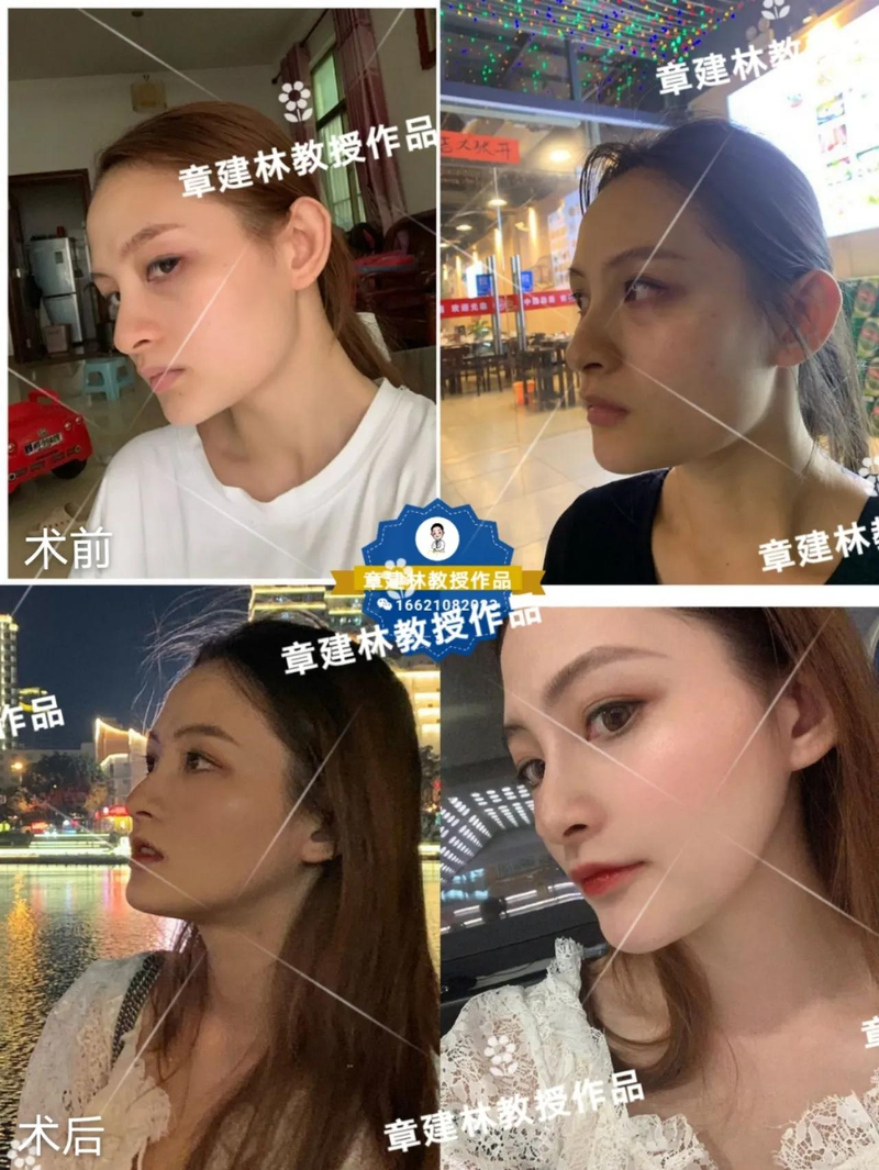 Related knowledge of plastics