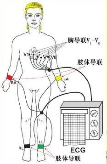 ecg心率的计算原理