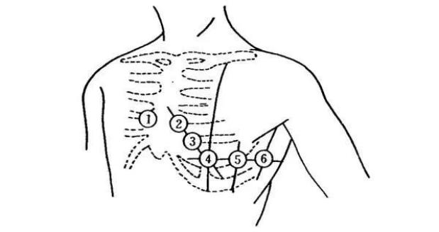 ecg心率的计算原理