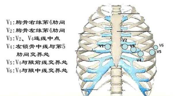 ecg心率的计算原理