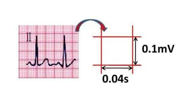 ecg心率的计算原理