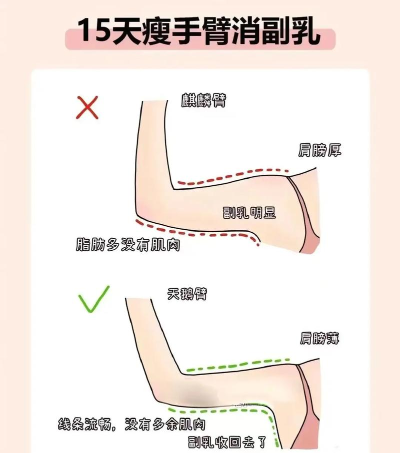 The most effective thin arm method