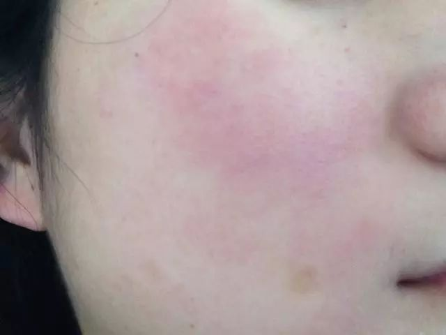 The mummies use the step