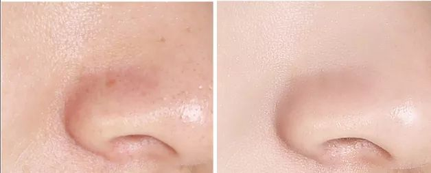 The mummies use the step