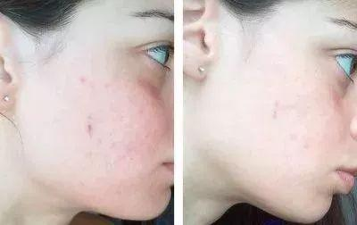 The mummies use the step