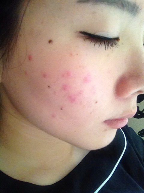 The mummies use the step