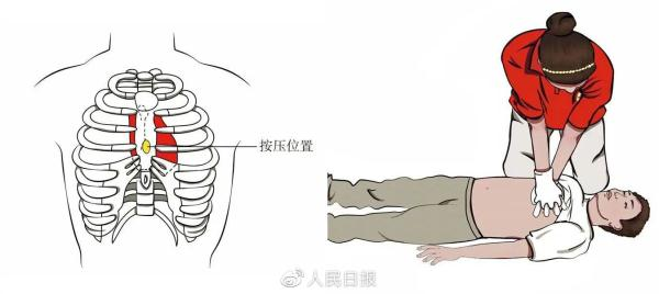 家庭触电急救方法