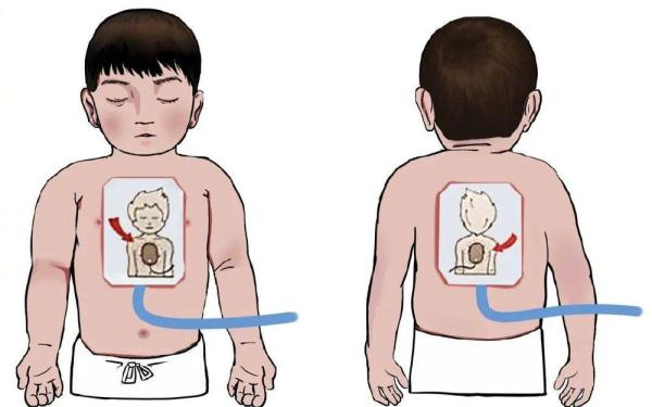 家庭触电急救方法