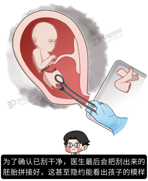 No pain-free experience