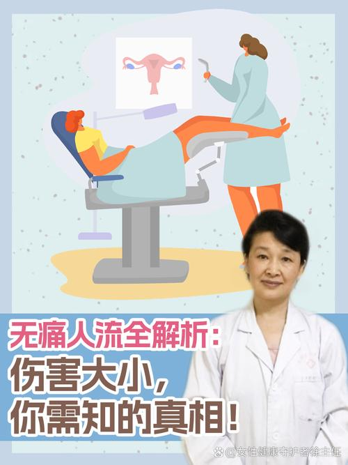 无痛人流经验