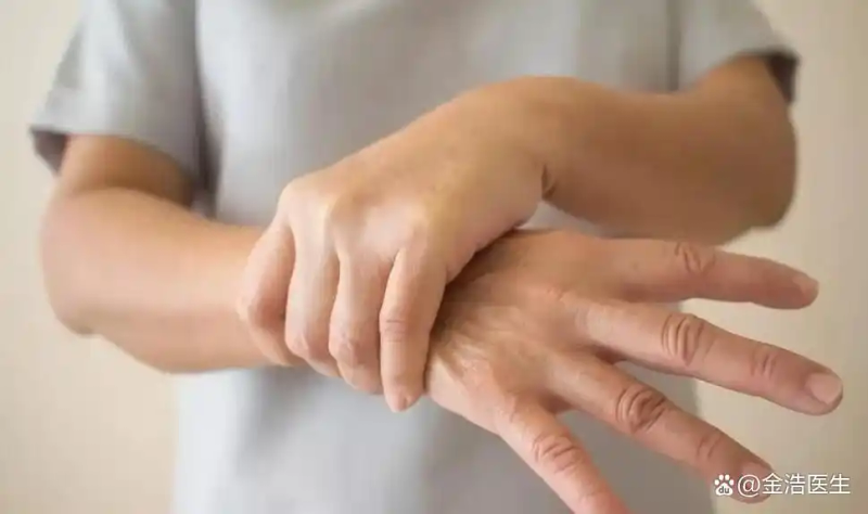 除了止痛药，还有哪些方法能改善痛风？