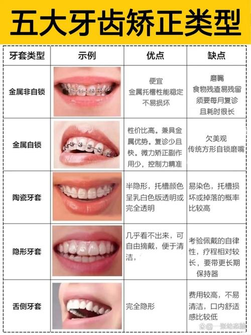 The type of toothbrush