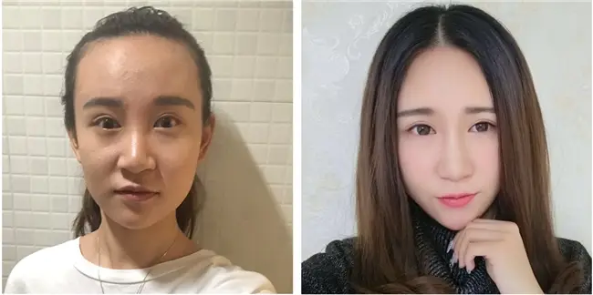 有什么祛斑的好方法