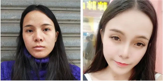 有什么祛斑的好方法