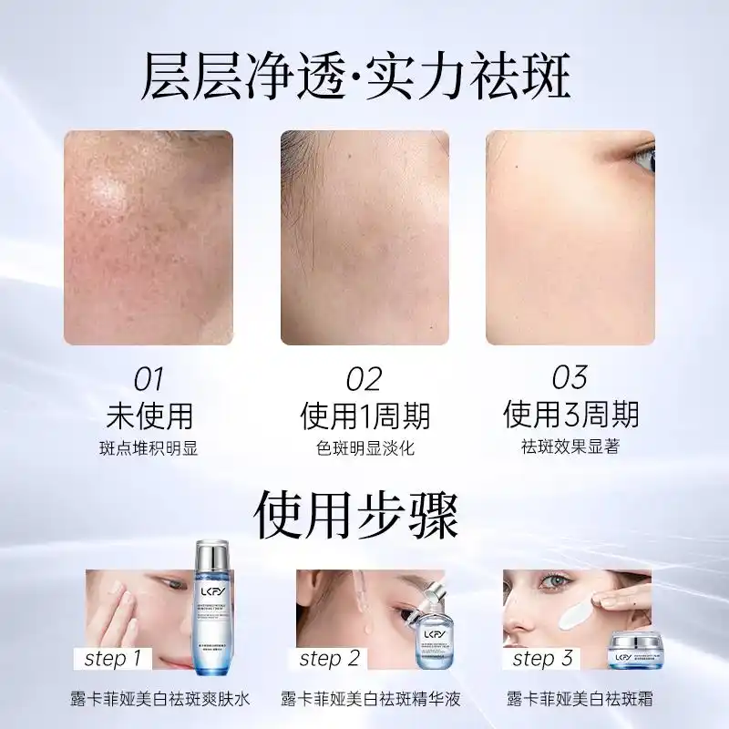 有什么祛斑的好方法